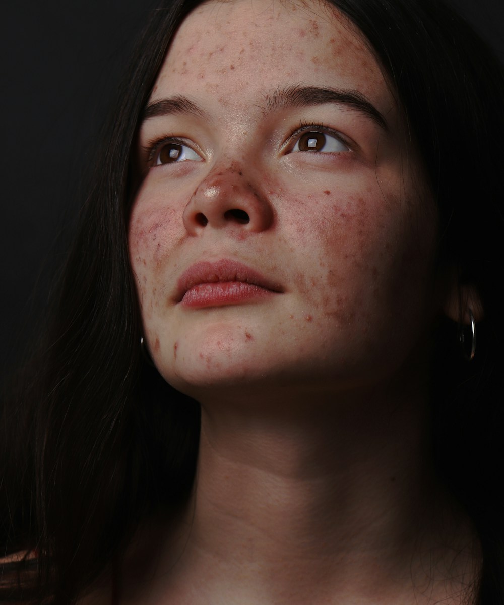 Demo stock portrait for before example